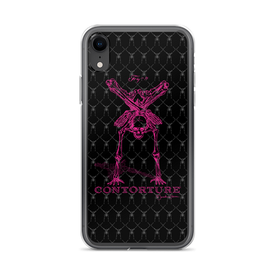 Contorture iPhone Case: Pinky Contortion Skeleton